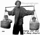 Father carrying sick twins to the hospital in baskets